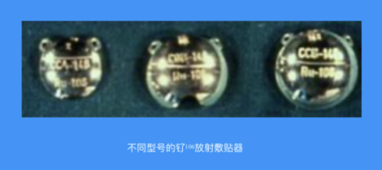 眼部腫瘤有救了!這種新療法不僅能治腫瘤還保眼球!